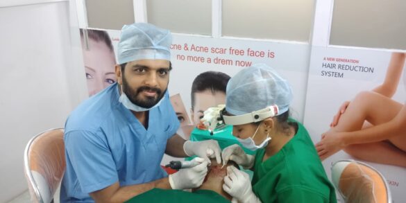 This image is about Dr Bhushan Bawankar performing a Hair transplant