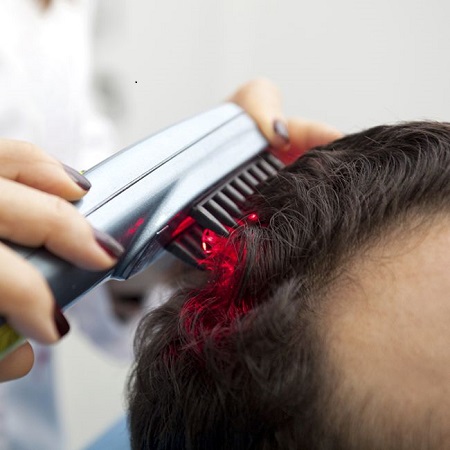 This Image tells us about laser hair treatment
