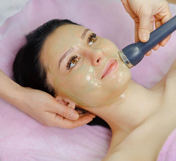 This image is about chemical peels