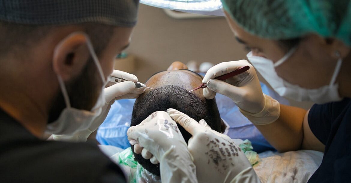 hair transplant treatment