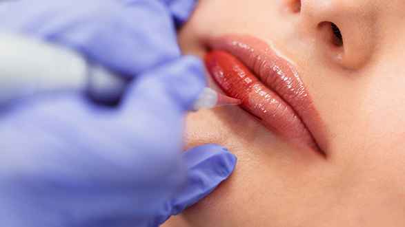 This image shows lip blush procedure been done on a women's lips