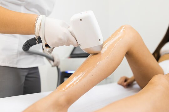 Image of hair removal treatment