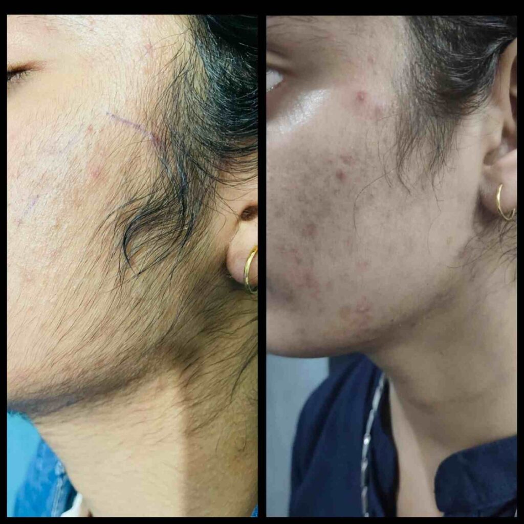 before and after treatment